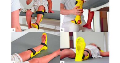 Passform der Lagerungsorthese an einer 8 Jahre alten Patientin mit infantiler Cerebralparese.