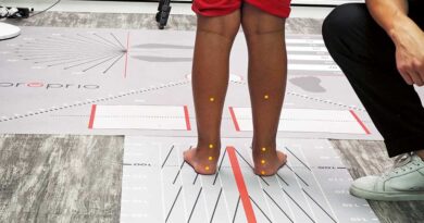 Ausgangspunkt für die Fertigung der ­Einlagen ist eine detaillierte Analyse des Fußes und des Gangbildes.