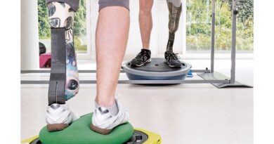 <img class="new_ribbon" width="25" height="25" src="https://360-ot.de/wp-content/uploads/2020/01/pluslogo.png">Peer Coun­seling: Weg­be­rei­ter für eine opti­mier­te Nach­be­hand­lung nach Amputation