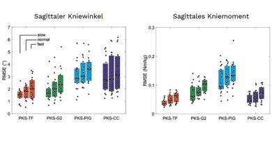 <img class="new_ribbon" width="25" height="25" src="https://360-ot.de/wp-content/uploads/2020/01/pluslogo.png">Gren­zen der Stan­dard­mo­del­le für die 3D-Bewe­gungs­ana­ly­se in der Pro­the­tik: Vor­stel­lung einer pro­ble­man­ge­pass­ten Lösung mit ers­ten prak­ti­schen Ergebnissen