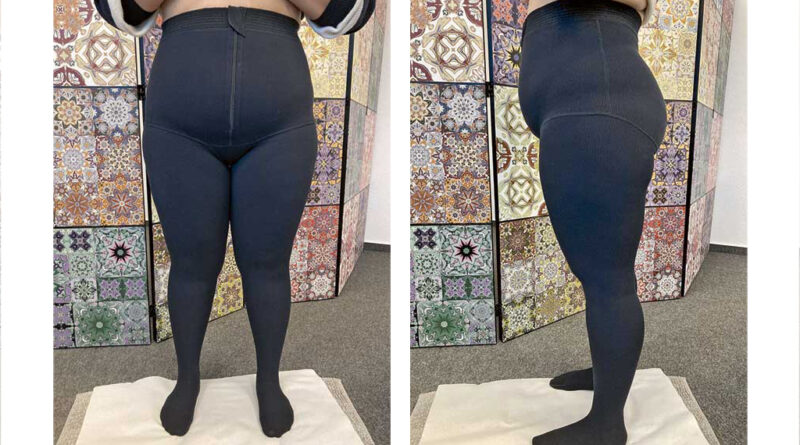 Das Team fertigt für die Patientinnen Kompression nach Maß an.