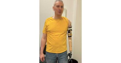 <img class="new_ribbon" width="25" height="25" src="https://360-ot.de/wp-content/uploads/2020/01/pluslogo.png">Prothesenversorgung nach transhumeraler Osseointegration mit Pattern-Recognition-Steuerung – Fallbericht einer Systemumstellung