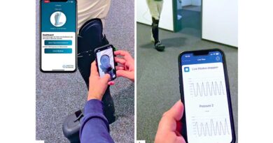 <img class="new_ribbon" width="25" height="25" src="https://360-ot.de/wp-content/uploads/2020/01/pluslogo.png">iOrt – Ent­wick­lung einer über­wa­chen­den Orthe­se mit neu­ar­ti­gem opti­schen Sensorsystem