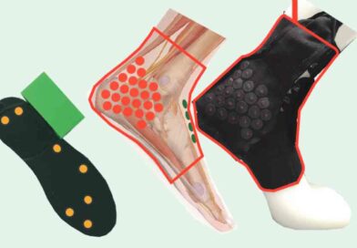 Die Elektroden sind auf Knöchelhöhe positioniert, da hier wichtige sensorische Nerven dicht unter der Haut verlaufen und sich leicht aktivieren lassen.