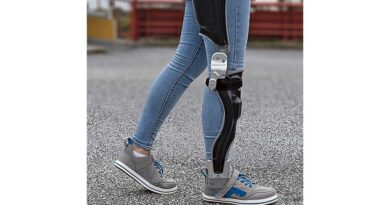 <img class="new_ribbon" width="25" height="25" src="https://360-ot.de/wp-content/uploads/2020/01/pluslogo.png">Mikro­pro­zes­sor­ge­steu­er­te stand- und schwung­pha­sen­kon­trol­lier­te Ganz­bein­or­the­sen (SSCO): Ent­wick­lung, Sys­te­me und Ver­sor­gungs­rea­li­tät in der ortho­pä­die­tech­ni­schen Praxis