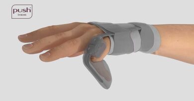 Die ortho­pä­die­tech­ni­sche Ver­sor­gung mit einer dyna­mi­schen Fin­ger­streck­or­the­se als eigen­stän­di­ge The­ra­pie bei der Dupuytren’schen Kontraktur