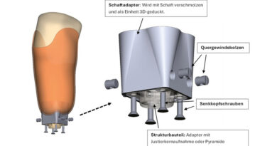 <img class="new_ribbon" width="25" height="25" src="https://360-ot.de/wp-content/uploads/2020/01/pluslogo.png">3D-gedruck­te Pro­the­sen­schäf­te: expe­ri­men­tel­le und nume­ri­sche Unter­su­chung der Schnitt­stel­le zu den Struk­tur­bau­tei­len nach DIN EN ISO 10328:2016