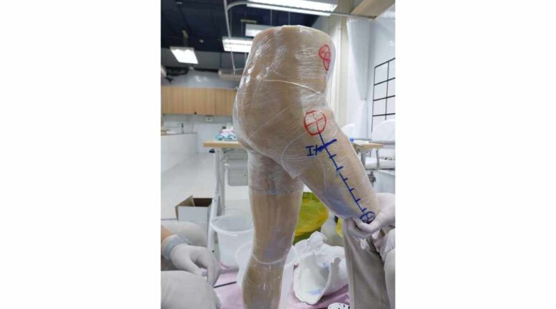 In den Werkstätten der Sirindhorn School of Prosthetics and Orthotics kann an lebensgroßen Modellen die Versorgung mit Oberschenkelprothesen geübt werden.